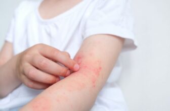 Examine Says U.S. Infants Are Lacking a Key Intestine Microbe, Fueling Allergy Danger